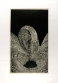 Transplantacja [Dokument ikonograficzny]