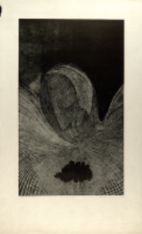 Transplantacja [Dokument ikonograficzny]